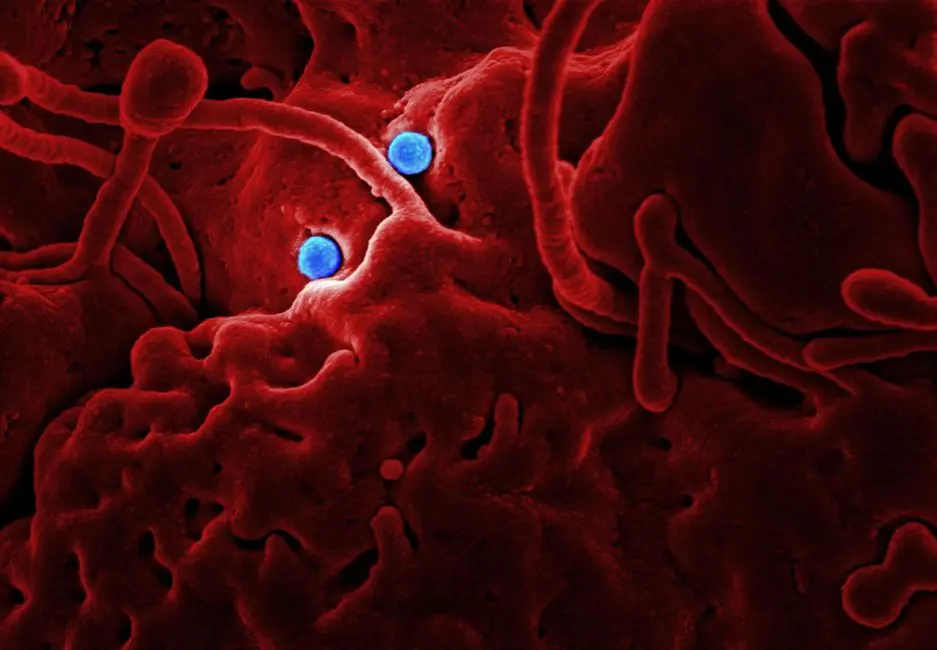 Emerging Insights: Elongation's Role in Disease and Therapeutic Avenues