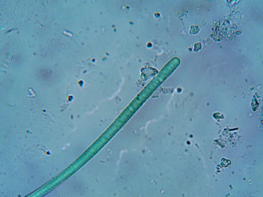 Dissect Structural Differences in Bacterial and Eukaryotic Cells