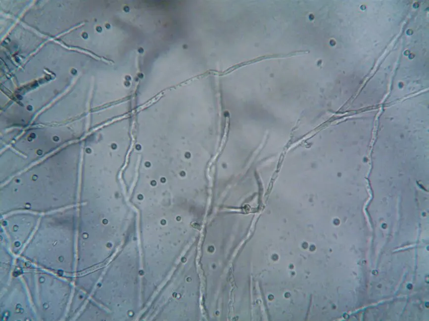 The Imperative for Cellular Proliferation: Why Cells Divide with Precision