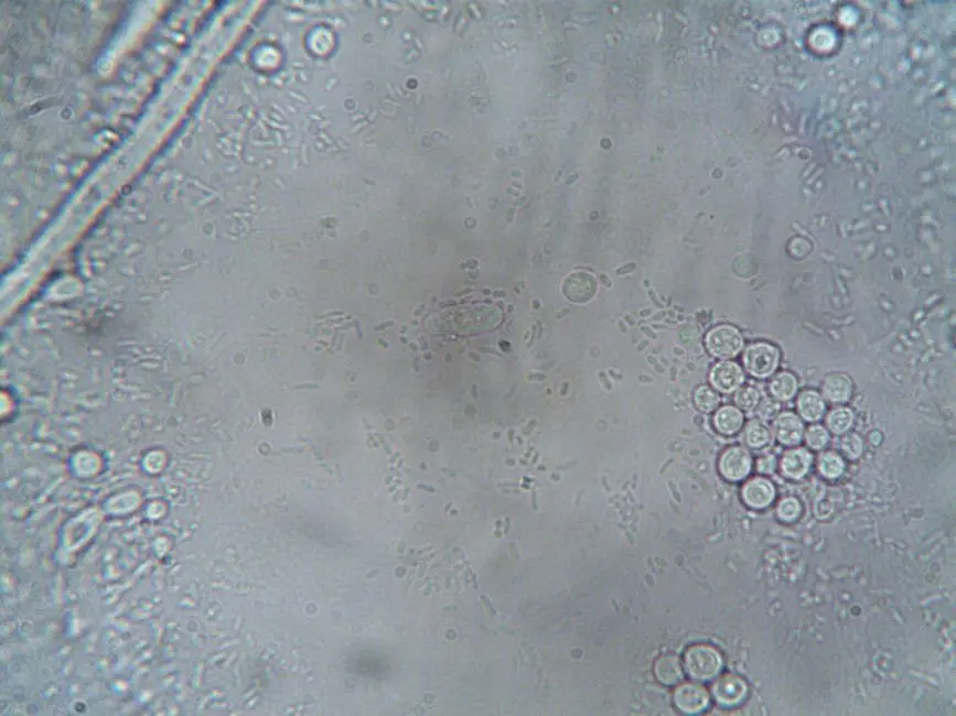 The Imperative of Live-Cell Imaging: Beyond Static Snapshots