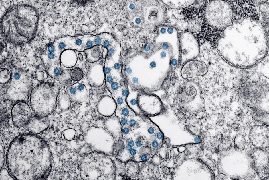 Advanced Techniques, Data Interpretation & Overcoming Live-Cell Imaging Challenges